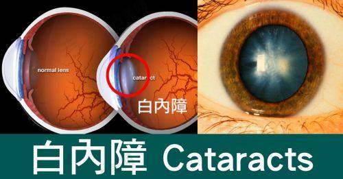大理爱尔眼科医院电话地址是啥？其在宾川路154号，电话0872 - 232****，多渠道可挂号