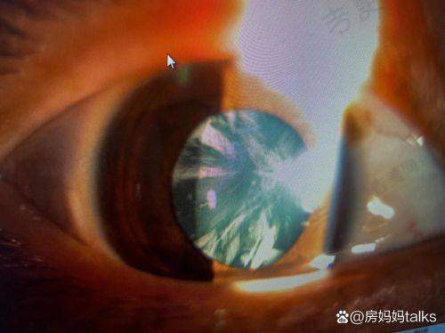 达州爱尔眼视光眼科医院医生团队