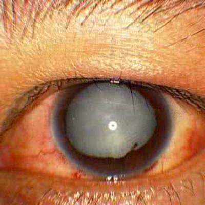 甘肃爱尔眼科医院在哪里？我整理了7家分院地址、乘车路线，速来种草！