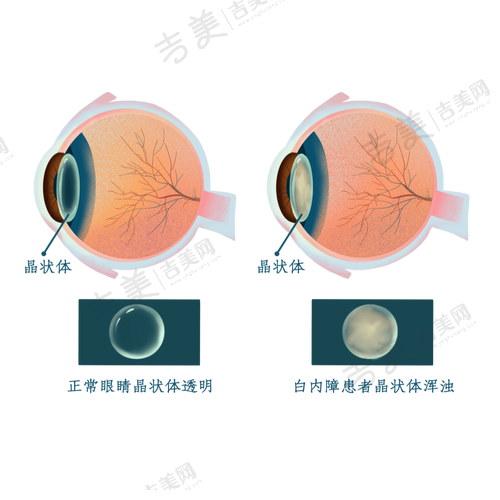 广州爱尔眼科医院上班时间说明