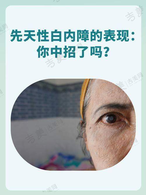 广州黄埔爱尔眼科医院挂号流程指南