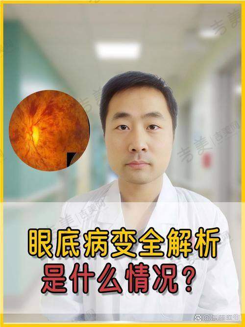 池州爱尔眼科医院的设备实力