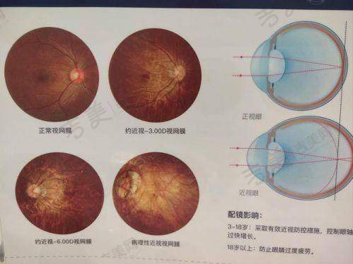贵阳爱尔眼科医院的未来展望