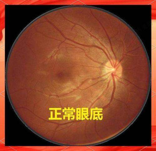 福州爱尔眼科医院连锁独特优势