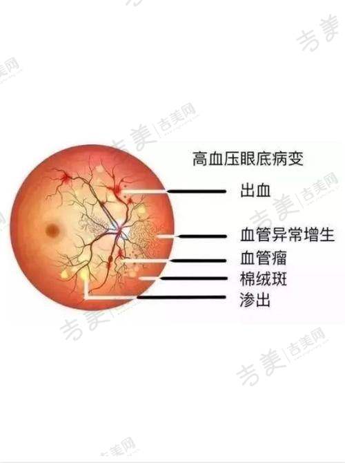 甘肃爱尔眼科医院斜视手术价格与成效良好