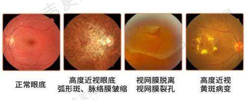 达州爱尔眼科医院价格参考