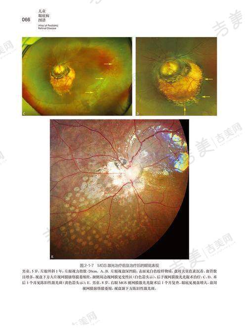 福州爱尔眼科医院的其他特色项目