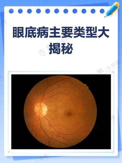 贵港爱尔眼科医院详细简介