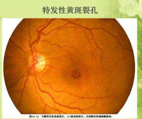 广州花都爱尔眼科医院专精的医疗团队
