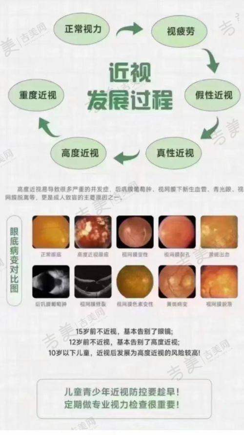 甘肃爱尔眼科医院就诊小贴士