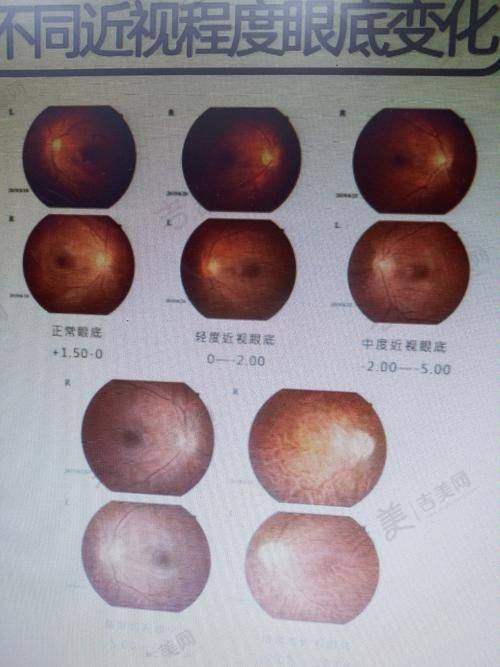 广州花都爱尔眼科医院贴心的服务特色