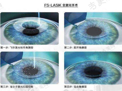 湛江爱尔奥理德眼科医院患者评价——眼肿物切除手术体验