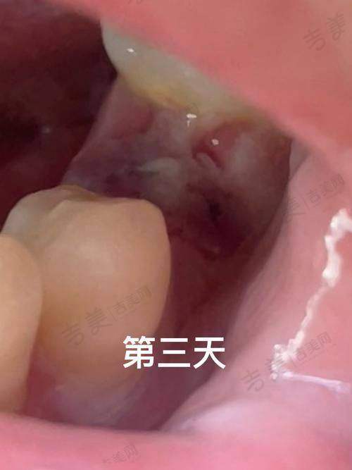 武汉德韩江岸口腔门诊部顾客实例