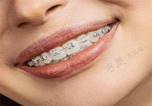 三、成都贝臣口腔医院地址在哪里？从成都东坡路到该地址的地铁路线