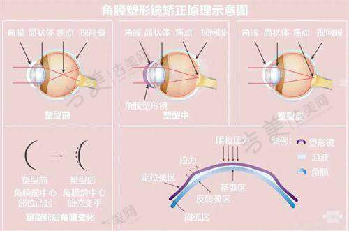 济南华厦眼科医院连锁品牌有啥优势?技术接轨设备精良