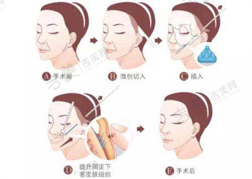 合肥艺星孙洋医生的技术优势体现在哪？