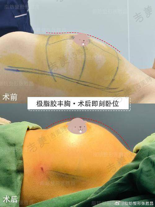 李冬医生怎么挂号