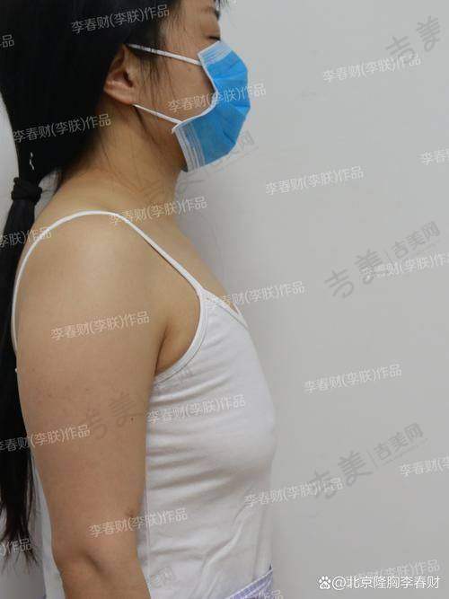 林华芬医生做完手术的感觉
