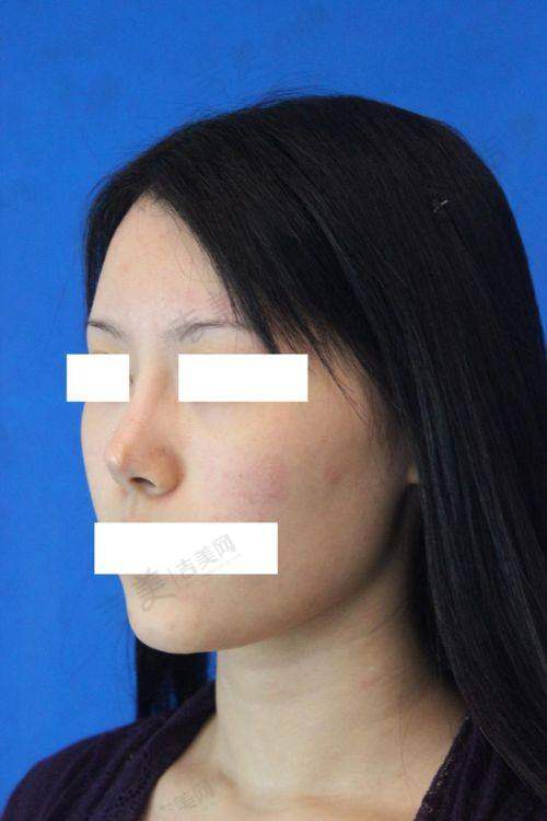 辛倩鸿怎么挂号