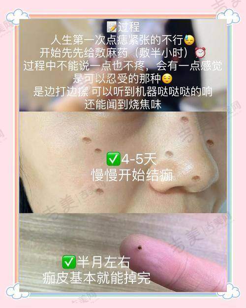 昆山哪个医院点痣好的高性价比医院之技术不错的医美诊所