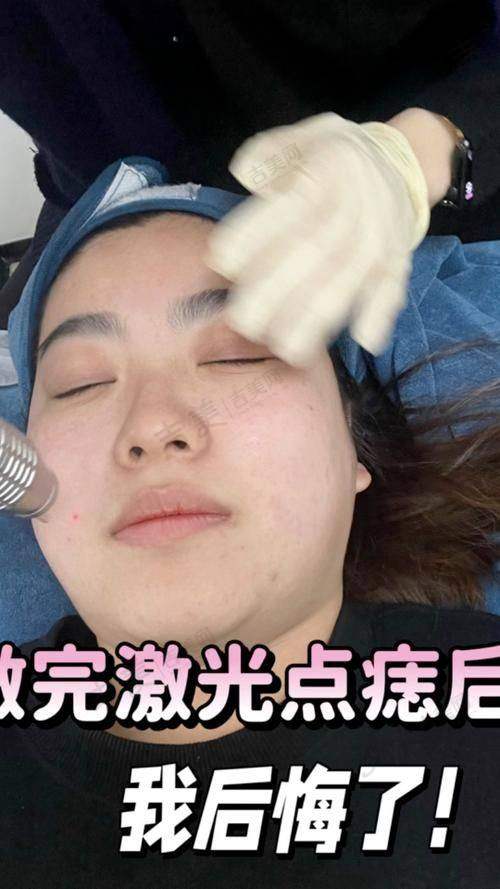 昆山哪个医院点痣好的高性价比医院之贴心服务的医美门诊