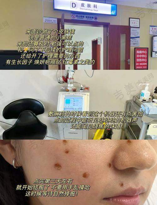 昆山哪个医院点痣好的高性价比医院之医美机构各有特色