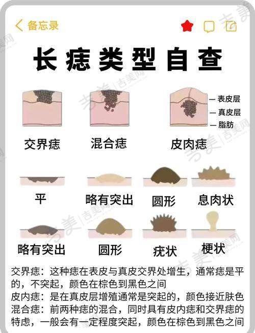 昆山哪个医院点痣好的高性价比医院之特色医院推荐