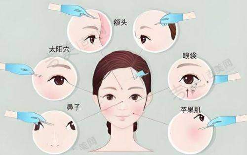伊维兰5D童颜针面部通用配比方法