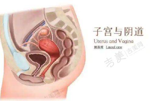 伊维兰私密针怎么用成效好之精细注射操作