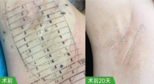 长沙美莱和亚韩哪家好？医生团队对比分析