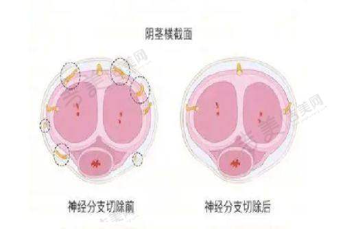 润蕾雅紧致针如何延长维持时间
