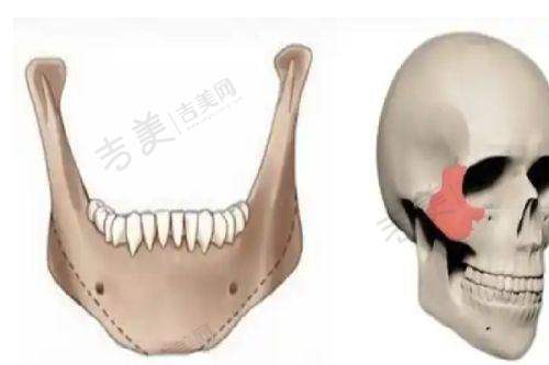 伊维兰私密针怎么用成效好之完善注射前后护理