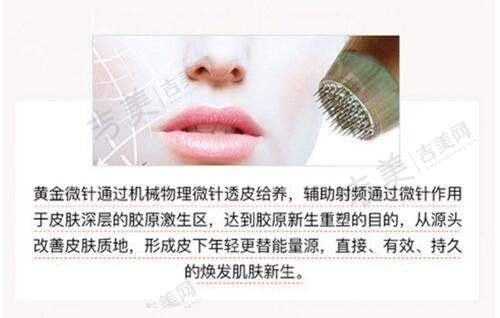 打紧缩针5个月感受之自信心明显增强