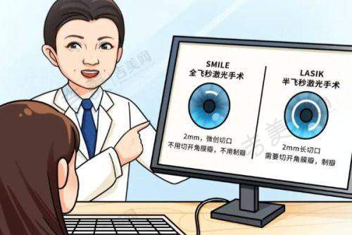 成都佰视佳眼科2025价格表中激光类手术价格如何?