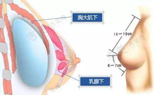 伊维兰胶原蛋白除皱原理详细揭秘