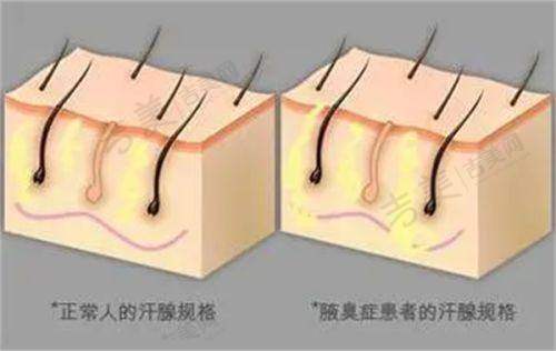 伊维兰5D童颜针配比过程中的注意事项