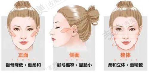 2025保定整形医院价格与服务体验如何？