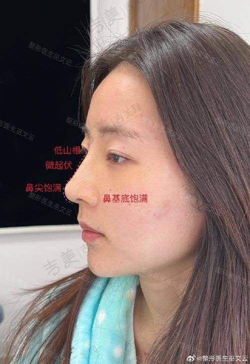 成昌燮医生手术费用