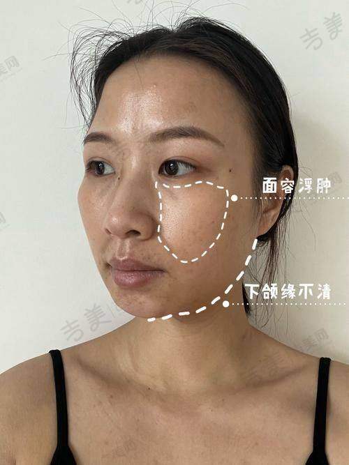 吴彩霞医生的真实评价如何