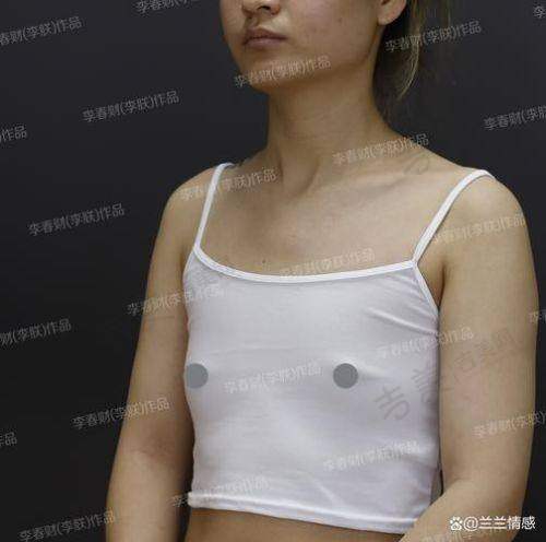 成昌燮医生做完手术的感觉