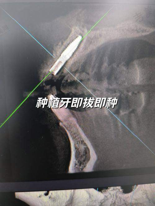 六、李建涛医生号怎么挂及相关事项