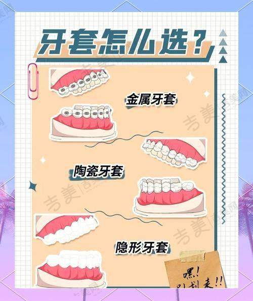 四、江苏淮安诺贝尔口腔医院项目特色