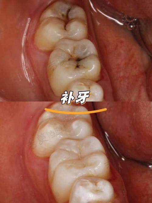 宁夏银川诺贝尔口腔医院口碑好不好?附真实患者口碑评价