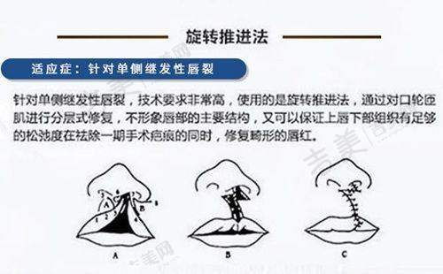 成都素美的口碑怎么样？良好口碑有目共睹