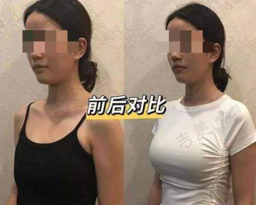 曹镜焕医生怎么挂号