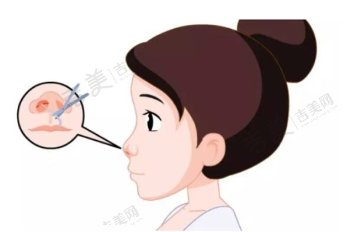 赵在勋医生怎么挂号预约