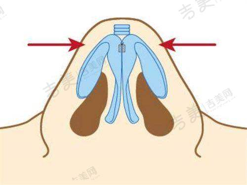 南京美莱整形是否正规？服务流程彰显规范