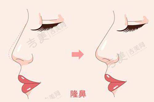 长春中妍美容医院是正规的吗？——专精团队实力强