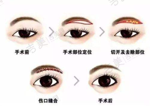 长春中妍美容医院是正规的吗？——连锁发展有保护