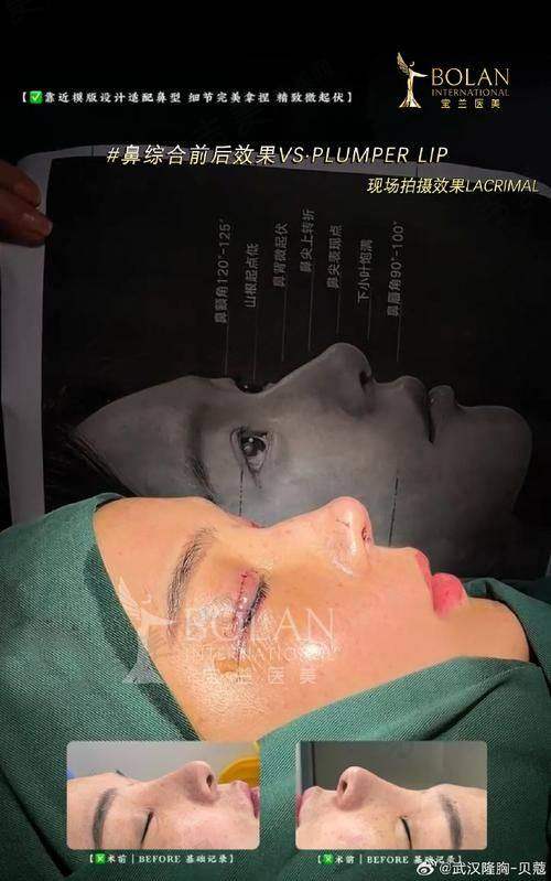 况佳丽医生属于什么级别
